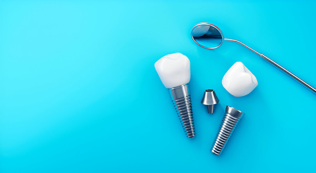 dental implants in white rock bc