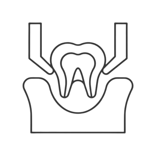 tooth extraction