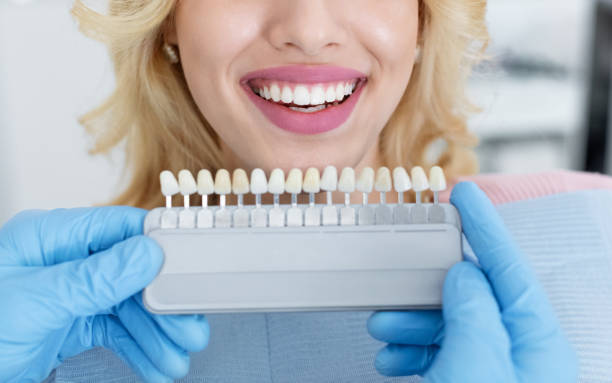 how porcelain crowns help restore your smile