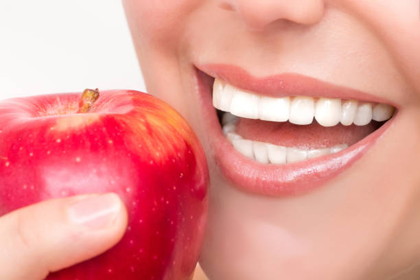 foods that naturally help keep teeth white