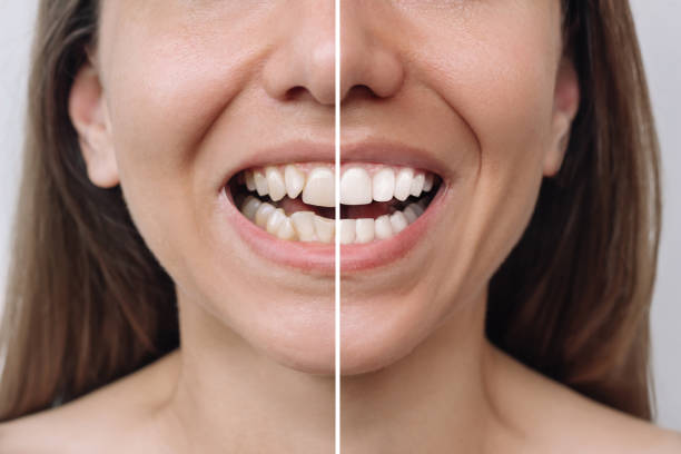 how dental implants change your daily life