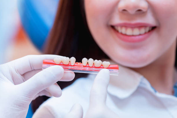 emergency care for broken crowns and bridges